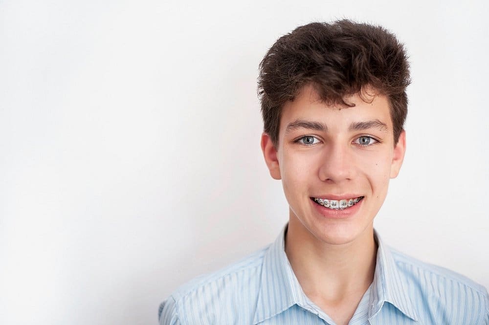 A teenage boy with curly dark hair and braces, showcasing the benefits of early orthodontic care, stands smiling confidently in a light blue striped shirt against a plain white background in San Antonio, TX