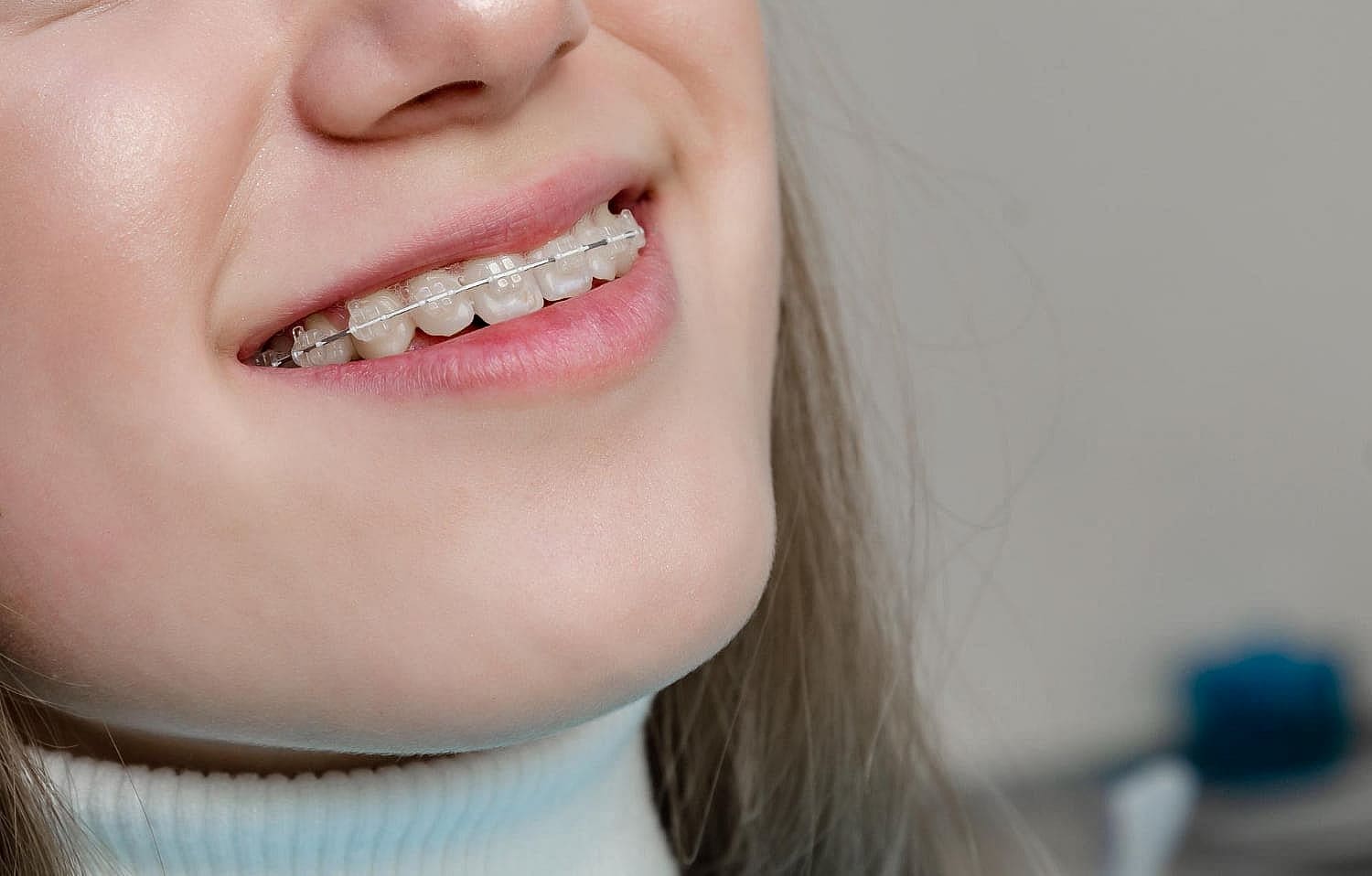 Close-up of a person smiling, showcasing adult braces on their upper teeth. The background is blurred in San Antonio, TX