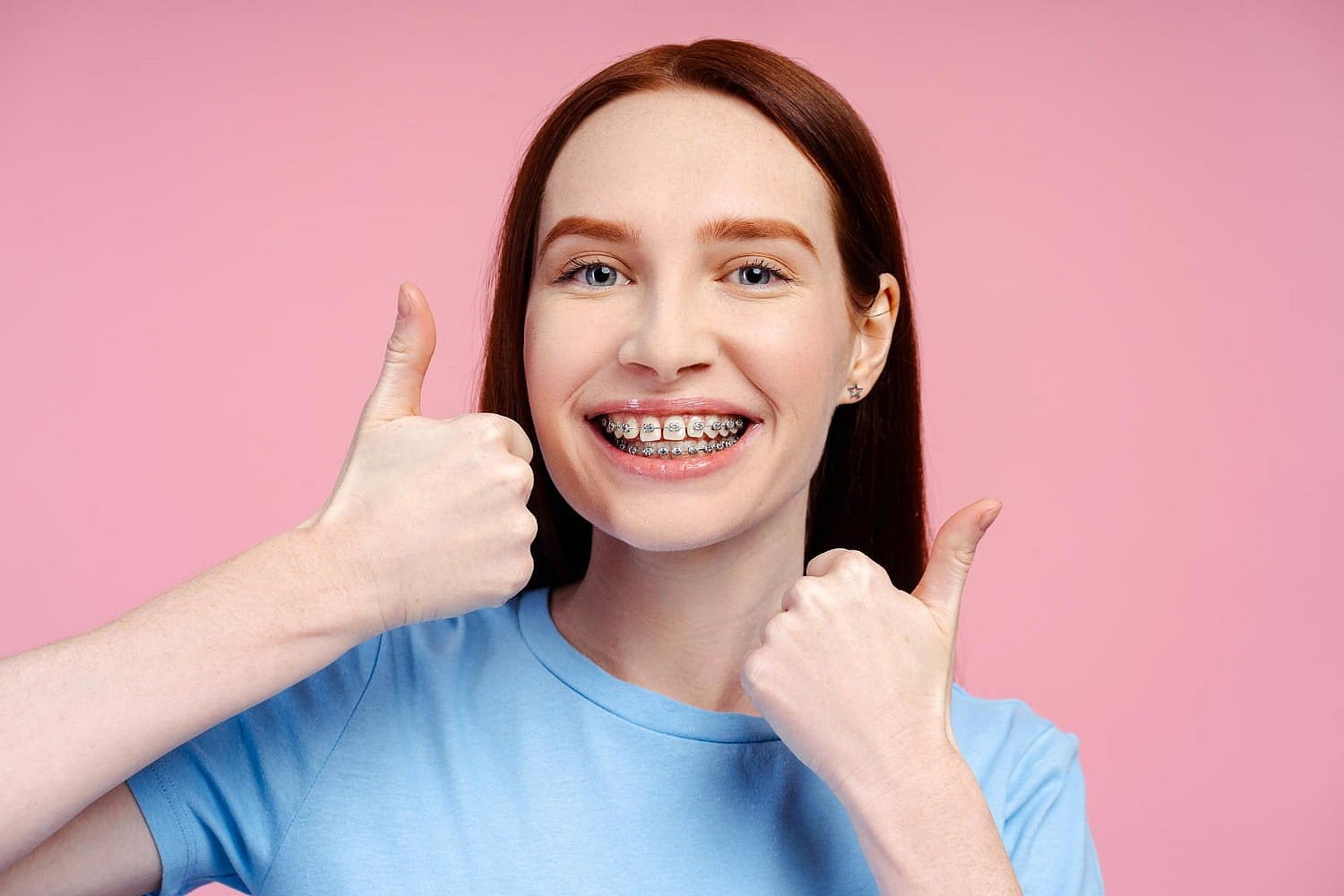 With long red hair and radiant confidence, this person gives a double thumbs-up while sporting braces near me and a light blue shirt, all set against a cheerful pink background in San Antonio, TX