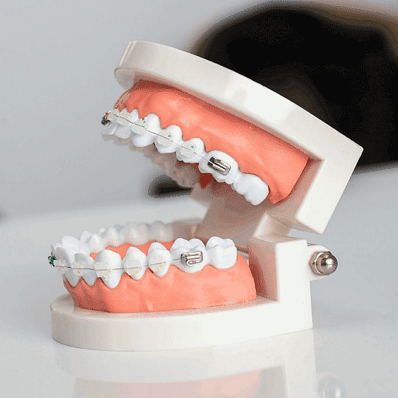 A dental model showcasing upper and lower teeth with braces aligned on a white base, set against a blurred background, illustrates the intricate work involved in orthodontics, which can often be supported by comprehensive orthodontic insurance plans in San Antonio, TX