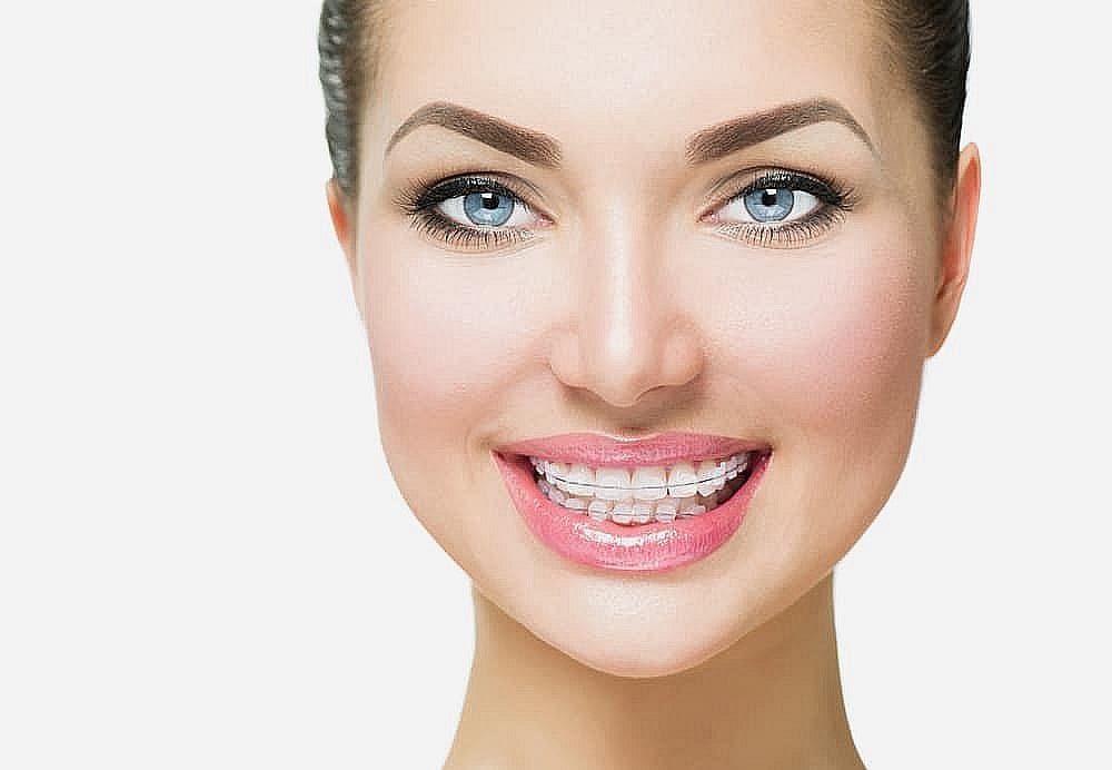 A person grins broadly, showcasing their clear braces on perfectly aligned teeth. Their light skin glows against the backdrop of striking blue eyes, while dark hair is neatly pulled back in San Antonio, TX