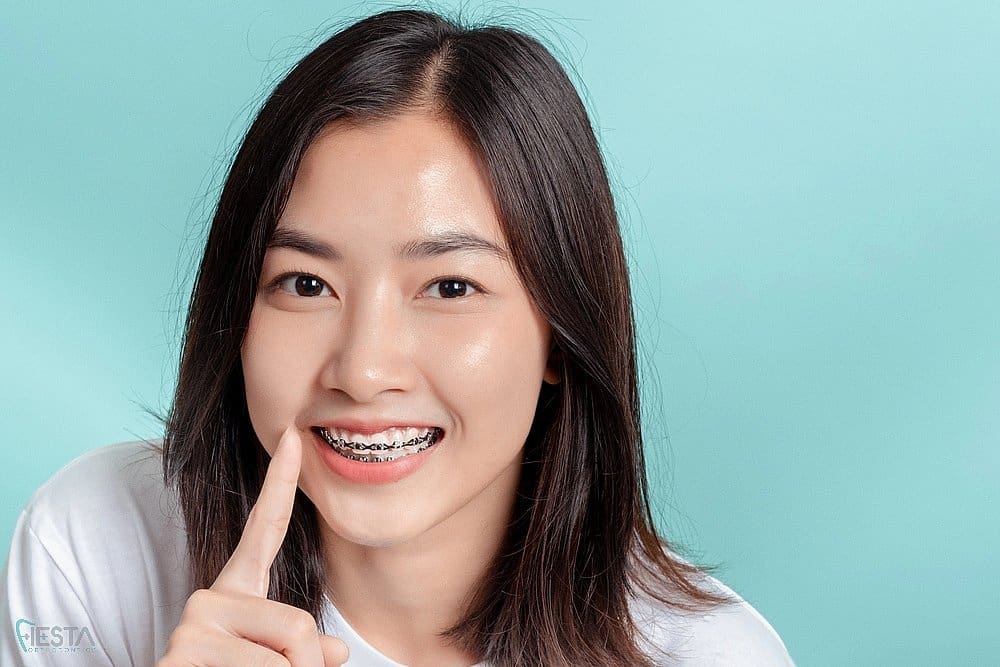 young asian woman wearing metal braces smiling after understanding about how long do braces take in San Antonio, TX