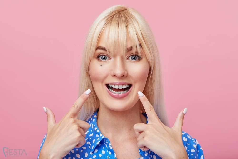 cheerful happy young woman blonde hair gesturing thumb while pointing clear braces - Clear Braces vs Metal Braces in San Antonio, TX 